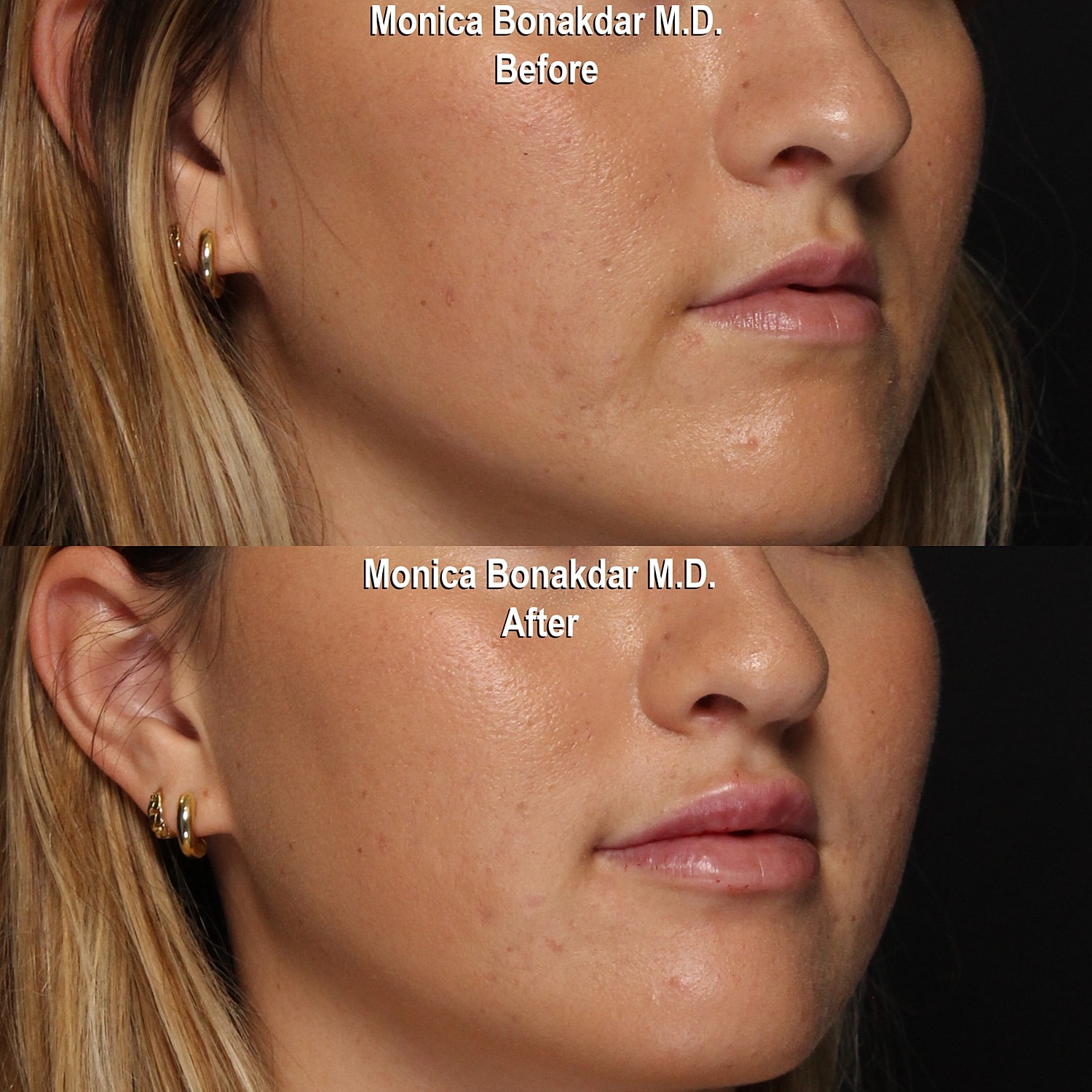 Before and after skin treatment comparison.